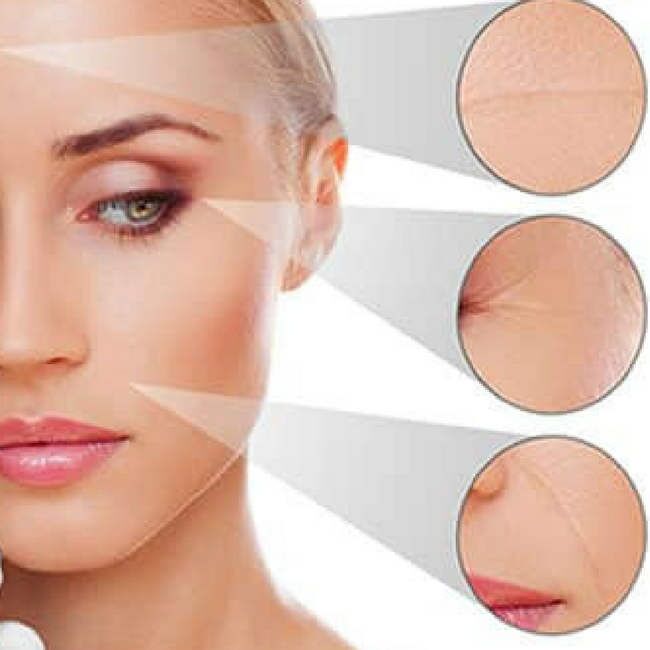 HIFU treatment with Ultraformer 3 - non-surgical facelift HIFU is non-invasinve procedure for skin lift.